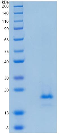 鵰 Recombinant Human IL38 / IL1F10 / IL1HY2 / FKSG75 Protein