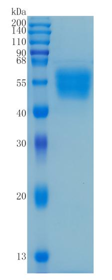 鵰 Recombinant Human IL1R1 / CD121A / D2S1473 / IL-1R-alpha / IL1R / IL1RA / P80 Protein