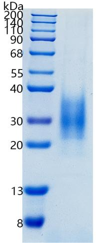 鵰 Recombinant Human IL22 / IL-D110 / TIFa / TIFIL-23 / ZCYTO18 Protein