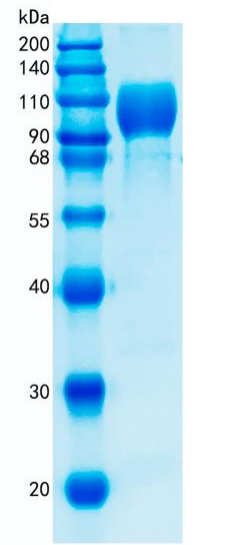 鵰 Recombinant Human IL23R / IBD17 / IL-23 R / IL-23 receptor Protein