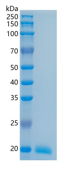 鵰 Recombinant Human IL28A / IFN-lambda 2 / IFNL2 / IFNL2a / IFNL3a Protein