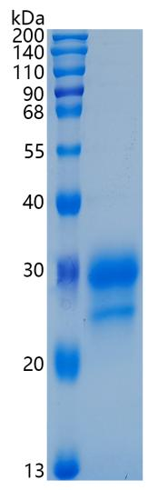 鵰 Recombinant Human IFN-lambda 1 / IL-29 / IFNL1 Protein