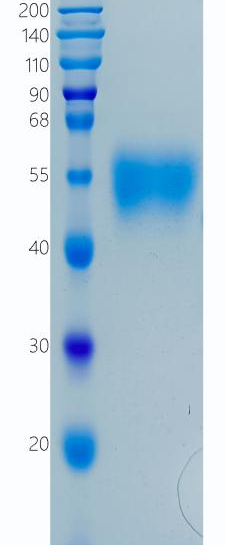 鵰 Recombinant Human IL-2RG / CD132 / CIDX / IMD4 / P64 / SCIDX Protein