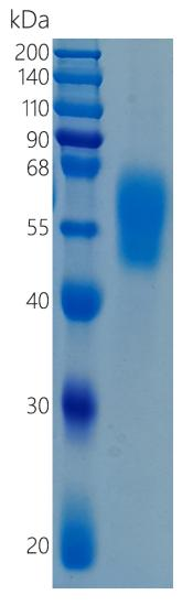 鵰 Recombinant Human IL36R / L1R-rp2 / IL1RRP2 / IL-1RL2 Protein