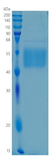 鵰 Recombinant Human CD123 / IL3R / IL3RA / IL3RAY / IL3RX / IL3RY Protein