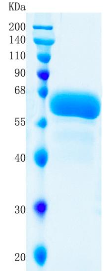 鵰 Recombinant Human OSMR / IL-31RB / OSMRB / PLCA1 / IL-31R-beta Protein