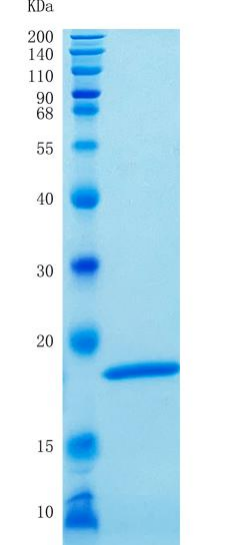 鵰 Recombinant Human IFN-alpha 2 / IFNA2 / IFN-alphaA / IFNA / IFNA2B / INFA2 Protein