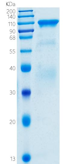 鵰 Recombinant Human Renin / REN / Prorenin / renal / HNFJ2 Protein