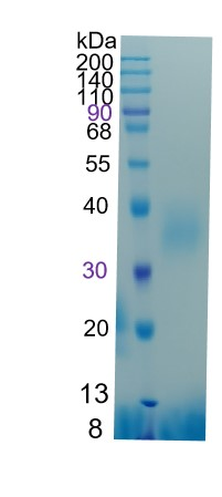 鵰 Recombinant Human PTH1R / PFE / PTHR / PTHR1 Protein