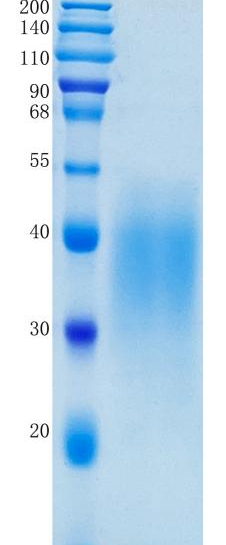 鵰 Recombinant Human SCF / Kitl / MGF / SF / SHEP7 / KITLG / DCUA Protein