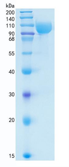 鵰 Recombinant Human SERPING1 / C1IN / C1INH / C1NH / HAE1 / HAE2 / serpin family G member 1 / C1IN / C1INH / C1NH / HAE1 / HAE2 Protein