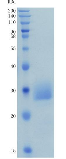 鵰 Recombinant Human CD32A / IGFR2 / FCGR2A / CDw32 / FCGR2 Protein (H167R)