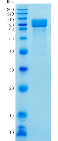 鵰 Recombinant Human SIDS / MPS2 / Iduronate 2 sulfatase Protein