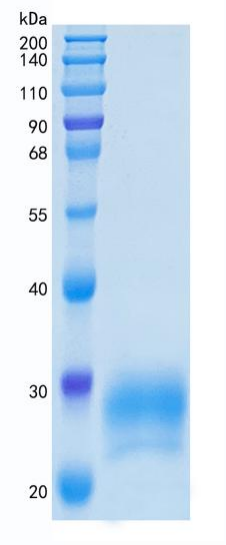 鵰 Recombinant Human FCGR2B / CD32 / CD32B / FCG2 / FCGR2 / IGFR2 Protein