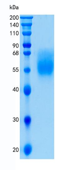 鵰 Recombinant Human CD327 / Siglec-6 / SIGLEC6 / CD33L / CD33L1 / OBBP1 Protein