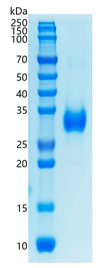 鵰 Recombinant Human Adiponectin Acrp30 ADIPOQ Protein