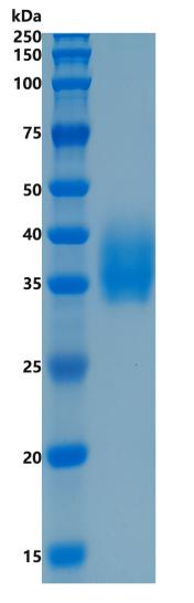 鵰Recombinant Human B7-H3 CD276 Protein