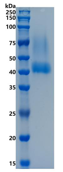 鵰Recombinant Human Biglycan BGN MRLS Protein