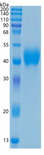 鵰 Recombinant Human TFPI / EPI / LACI / TFI Protein