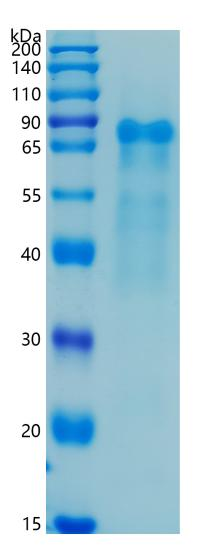 鵰 Recombinant Human Thrombomodulin / CD141 / THBD / TM / THRM Protein