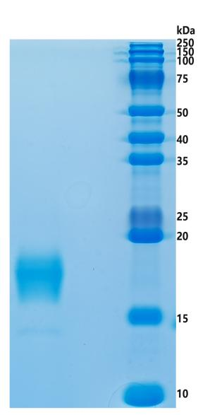 鵰 Recombinant Human VSIG9 / VSTM3 / WUCAM / TIGIT Protein