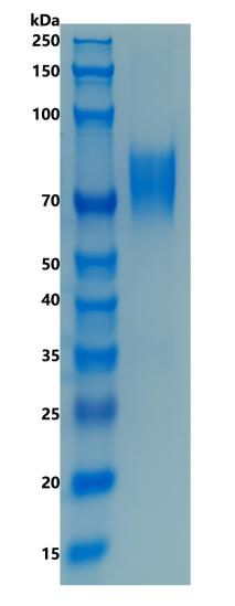 鵰 Recombinant Human TIM 3 / HAVCR2 / CD366 / KIM-3 / SPTCL Protein