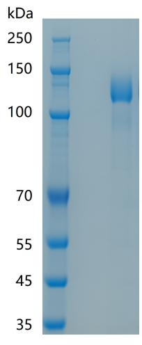 鵰 Human CD130 Protein Recombinant