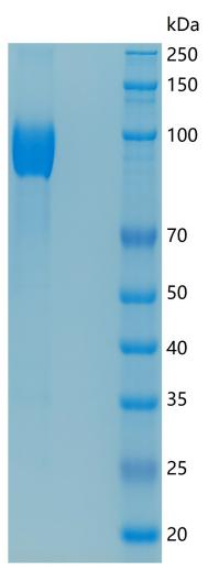 鵰 Recombinant Human IL17RA CD217 Protein