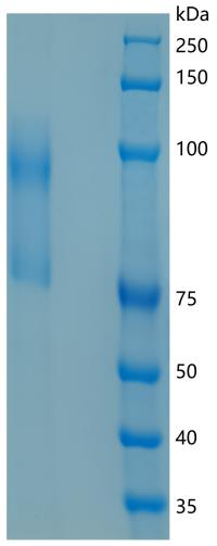 鵰 Recombinant Mouse CD62L L-Selectin SELL Protein