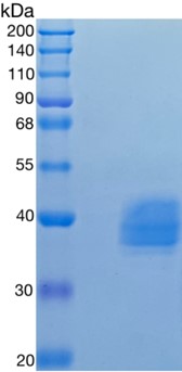 �������鵰�� Recombinant Human BST1 / CD157 / Bone marrow stromal cell antigen 1 Protein