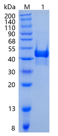 �������鵰�� Recombinant Human Carbonic Anhydrase 14 / CA-XIV / CA14 Protein