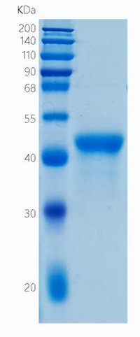 �������鵰�� Recombinant Human VSIG4 / Z39IG / CRIg Protein