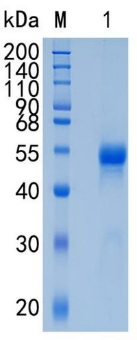 �������鵰�� Recombinant Human Netrin G1 / Laminet-1 / NTNG1 / KIAA0976 / LMNT1 Protein